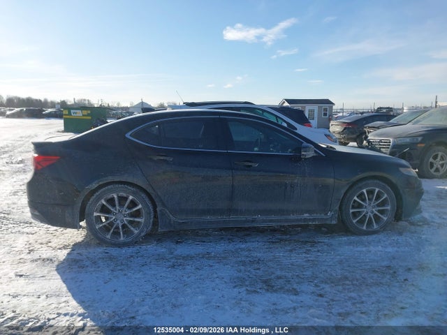 Acura TLX TECH 2015 19UUB3F55FA802807 Image 13
