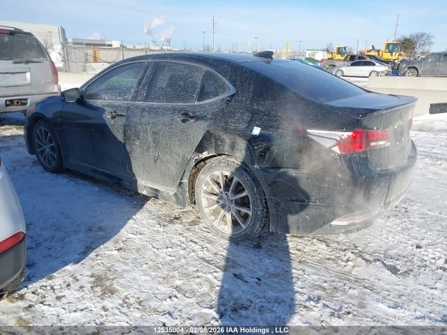 Acura TLX TECH 2015 19UUB3F55FA802807 Image 3