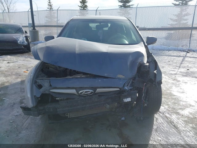 12535300 :رقم المزاد ، KMHCU5AE3DU077111 vin ، 2013 Hyundai Accent Gls مزاد بيع