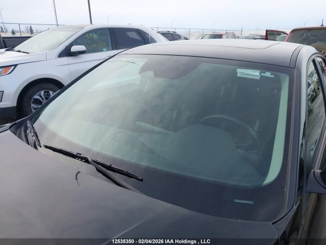 KMHLM4DGXRU776332 Hyundai ELANTRA SEL