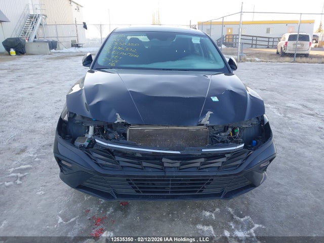 KMHLM4DGXRU776332 Hyundai ELANTRA SEL