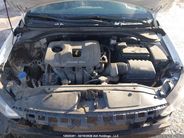 KMHD84LF1JU478032 Hyundai ELANTRA GL