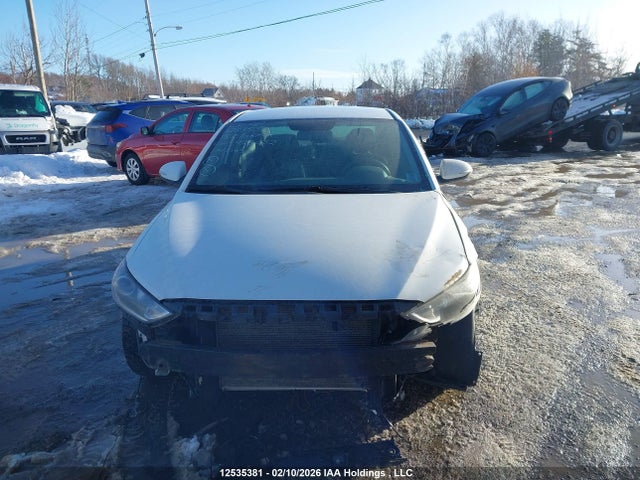 KMHD84LF1JU478032 Hyundai ELANTRA GL