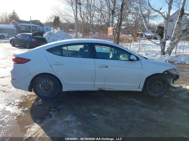KMHD84LF1JU478032 Hyundai ELANTRA GL