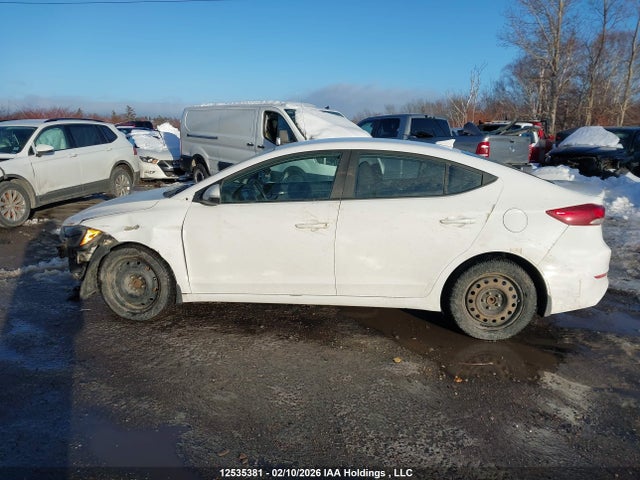 KMHD84LF1JU478032 Hyundai ELANTRA GL