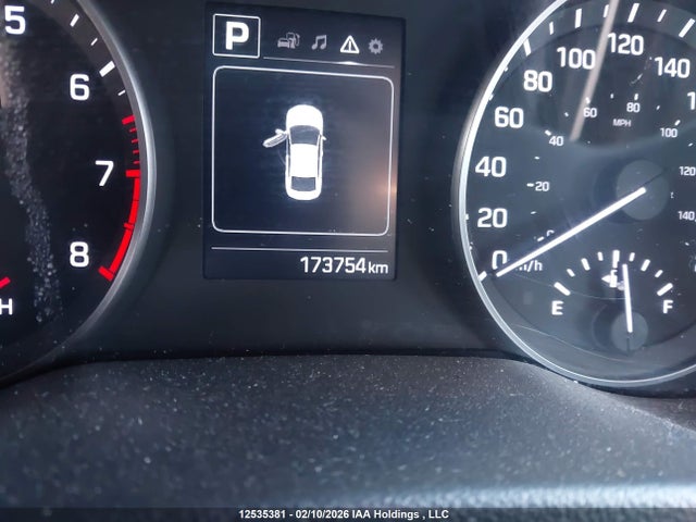 KMHD84LF1JU478032 Hyundai ELANTRA GL
