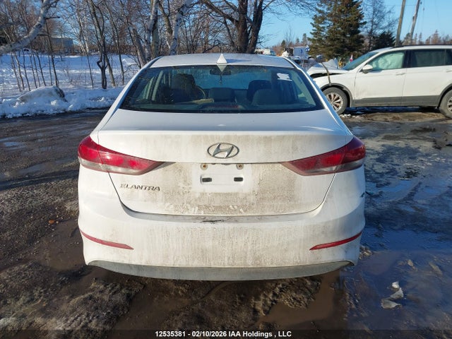 KMHD84LF1JU478032 Hyundai ELANTRA GL