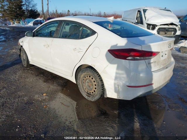 KMHD84LF1JU478032 Hyundai ELANTRA GL