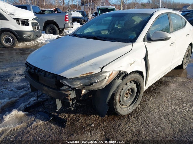 KMHD84LF1JU478032 Hyundai ELANTRA GL