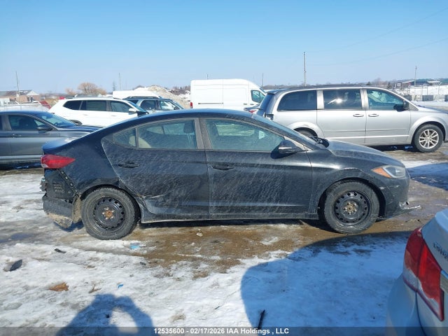 KMHD84LF2HU186531 Hyundai ELANTRA GL