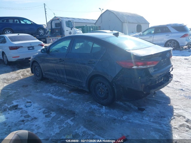 KMHD84LF2HU186531 Hyundai ELANTRA GL