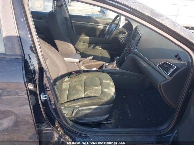 KMHD84LF2HU186531 Hyundai ELANTRA GL