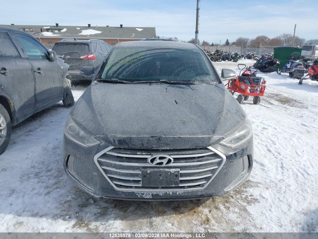KMHD84LF5JU553265 Hyundai Elantra Sel/value/limited