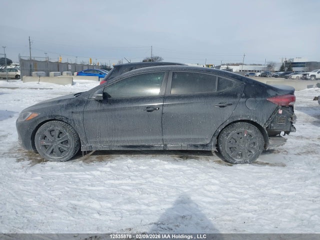 KMHD84LF5JU553265 Hyundai Elantra Sel/value/limited