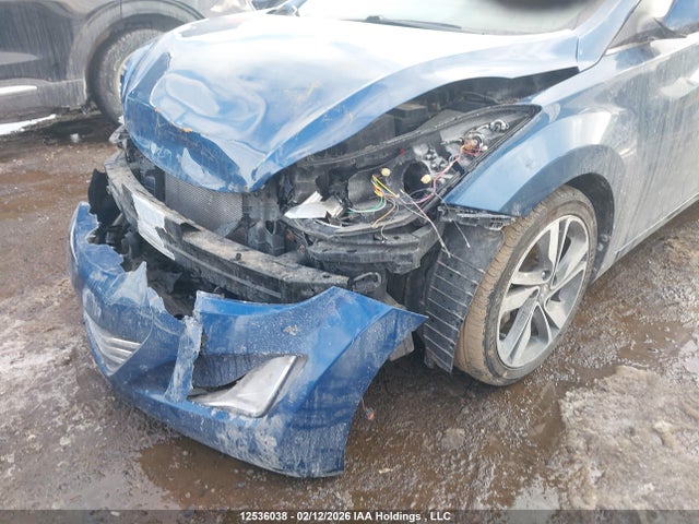 KMHDH4AH5GU639608 Hyundai Elantra Limited