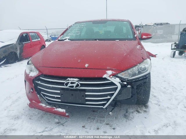 KMHD84LF3HU173951 Hyundai ELANTRA GL