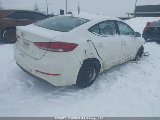 KMHD84LFXJU695160 Hyundai ELANTRA GL