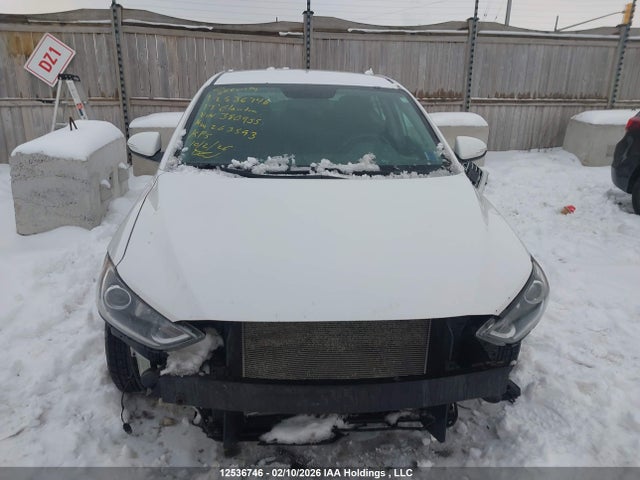 KMHD84LF5HU380955 Hyundai ELANTRA GL