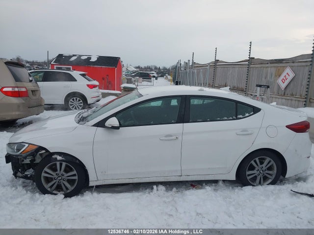 KMHD84LF5HU380955 Hyundai ELANTRA GL