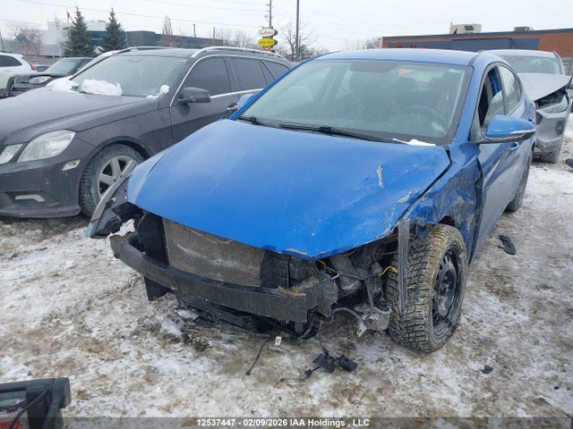 KMHD84LF1JU553425 Hyundai ELANTRA GL