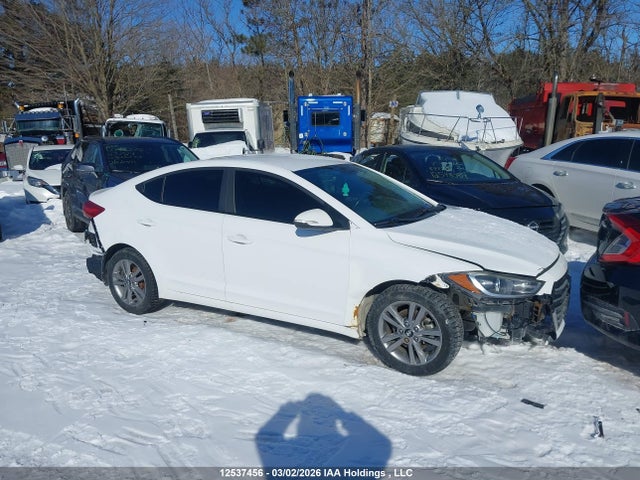 KMHD84LF6HU398123 Hyundai ELANTRA GL