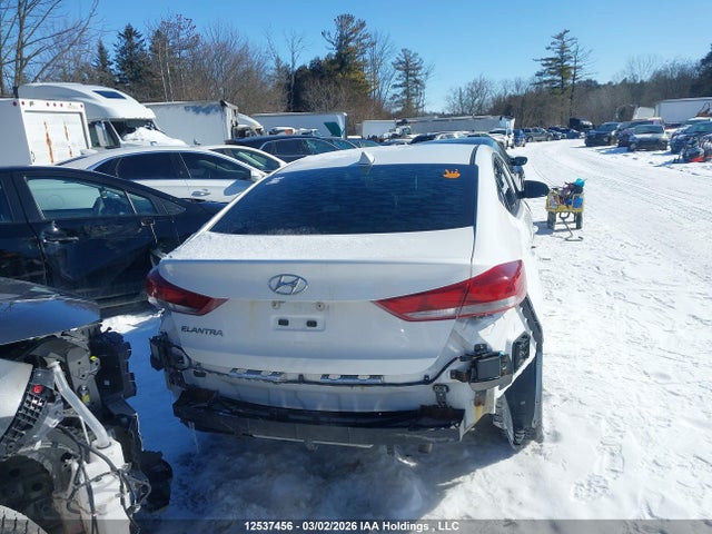 KMHD84LF6HU398123 Hyundai ELANTRA GL
