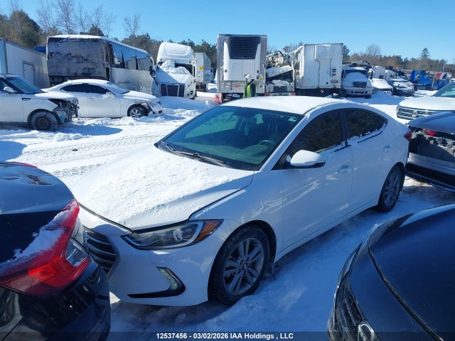KMHD84LF6HU398123 Hyundai ELANTRA GL