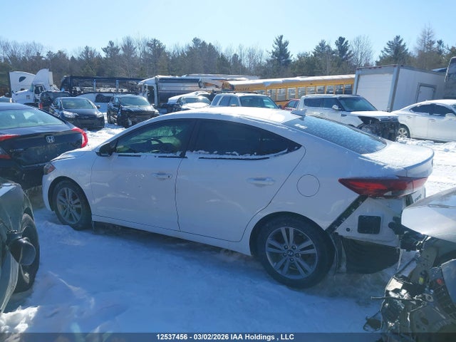 KMHD84LF6HU398123 Hyundai ELANTRA GL
