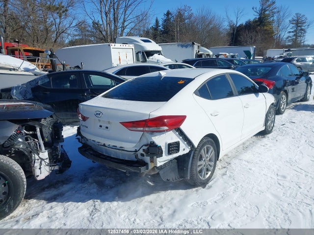 KMHD84LF6HU398123 Hyundai ELANTRA GL