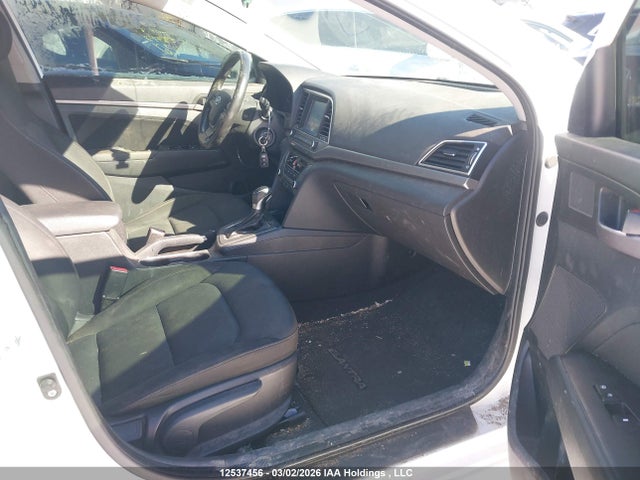 KMHD84LF6HU398123 Hyundai ELANTRA GL