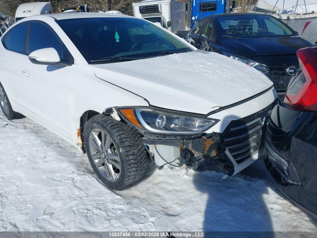 KMHD84LF6HU398123 Hyundai ELANTRA GL