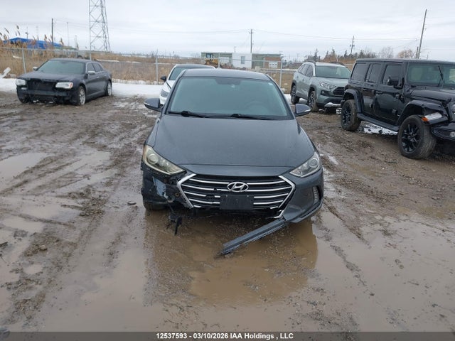 KMHD84LFXHU140834 Hyundai ELANTRA GL