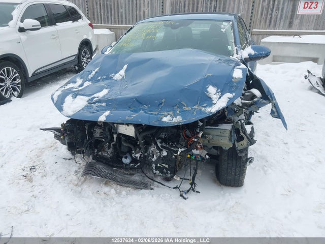Volkswagen JETTA SE 2025 3VWEX7BU2SM034786 Image 6