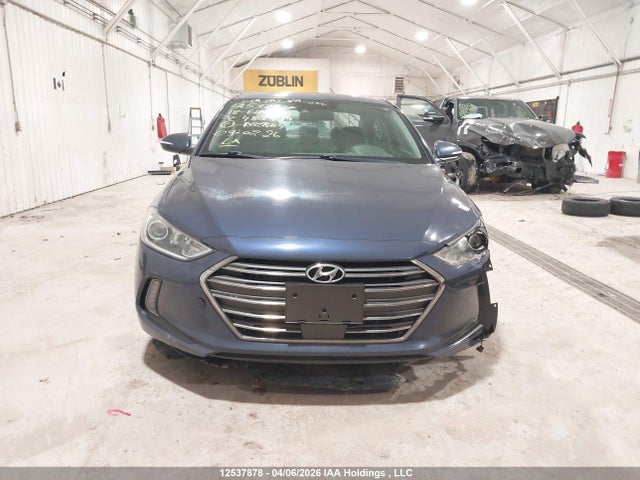 KMHD84LF4JU482429 Hyundai Elantra Sel/value/limited