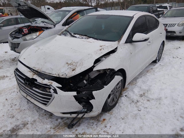 KMHD84LFXJU633046 Hyundai Elantra Sel/value/limited