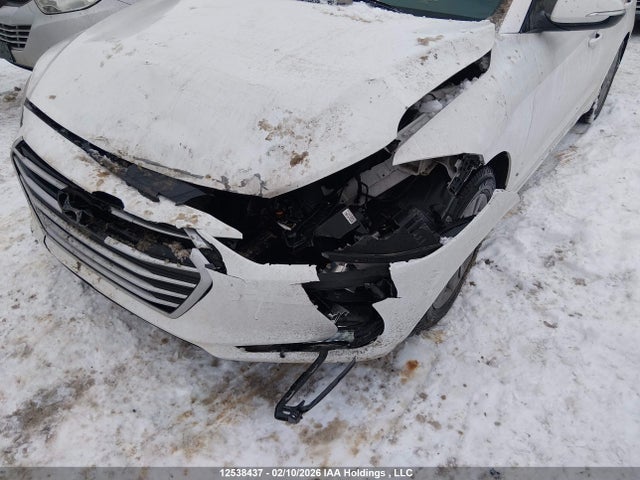 KMHD84LFXJU633046 Hyundai Elantra Sel/value/limited