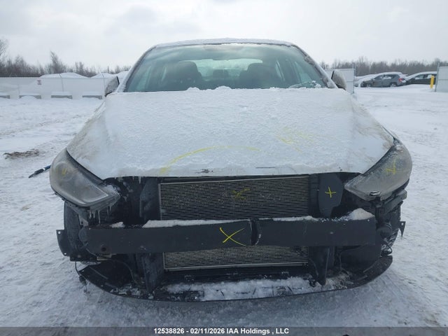 KMHD84LF2JU468335 Hyundai Elantra Sel/value/limited