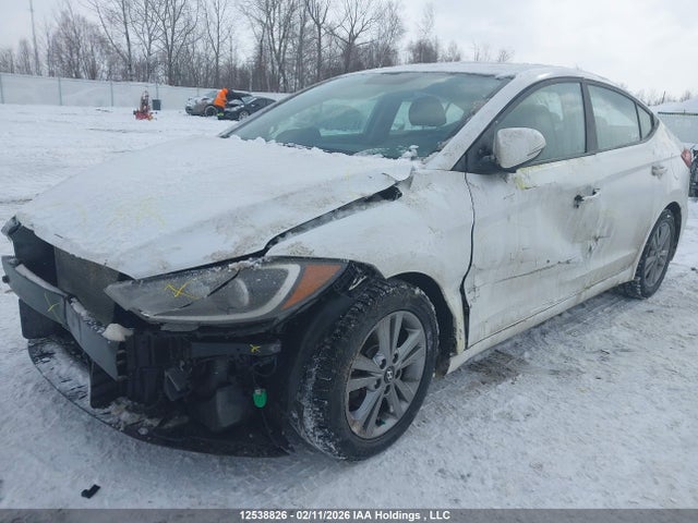 KMHD84LF2JU468335 Hyundai Elantra Sel/value/limited