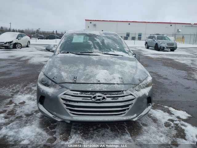 12539513 :رقم المزاد ، 5NPD74LF5HH062531 vin ، 2017 Hyundai Elantra L مزاد بيع