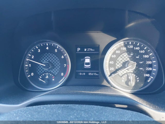 KMHD84LF5KU793241 Hyundai Elantra Sel/value/limited