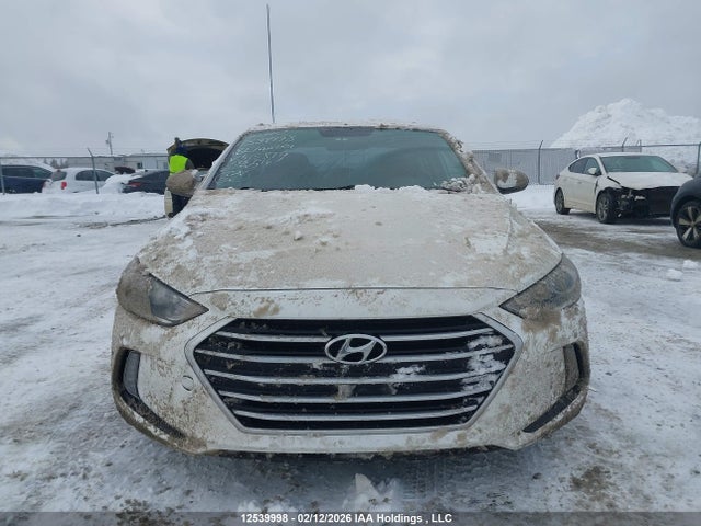 KMHD84LF4JU515879 Hyundai ELANTRA GL