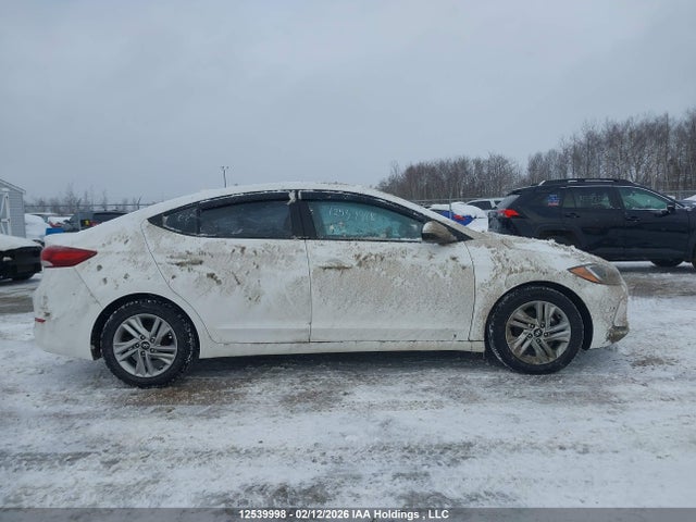 KMHD84LF4JU515879 Hyundai ELANTRA GL