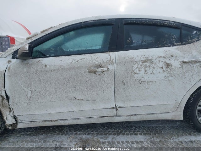 KMHD84LF4JU515879 Hyundai ELANTRA GL