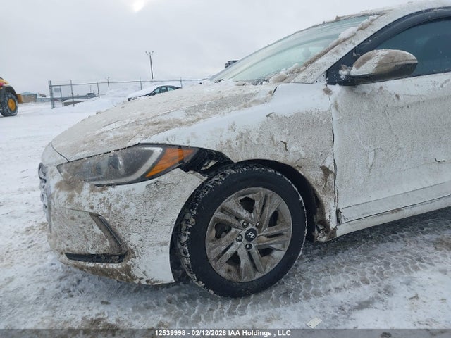 KMHD84LF4JU515879 Hyundai ELANTRA GL