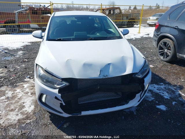 KMHD84LF1JU592807 Hyundai Elantra Sel/value/limited