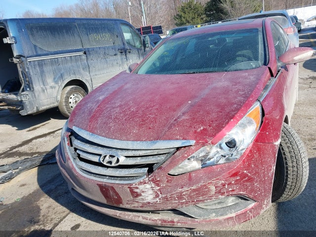 12540706 :رقم المزاد ، 5NPEB4AC8EH821406 vin ، 2014 Hyundai Sonata Gls مزاد بيع