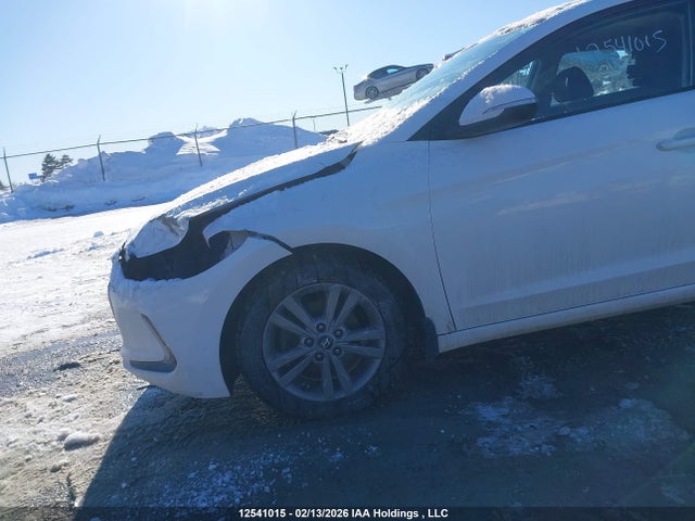 KMHD84LF1JU577546 Hyundai ELANTRA GL
