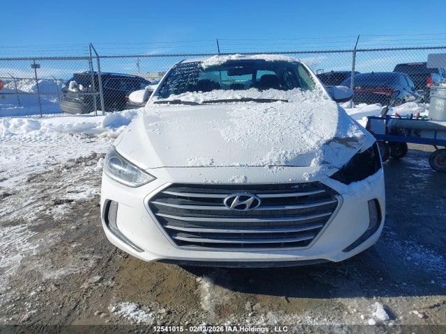 KMHD84LF1JU577546 Hyundai ELANTRA GL