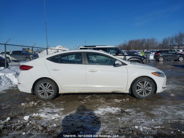 KMHD84LF1JU577546 Hyundai ELANTRA GL