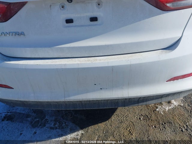 KMHD84LF1JU577546 Hyundai ELANTRA GL